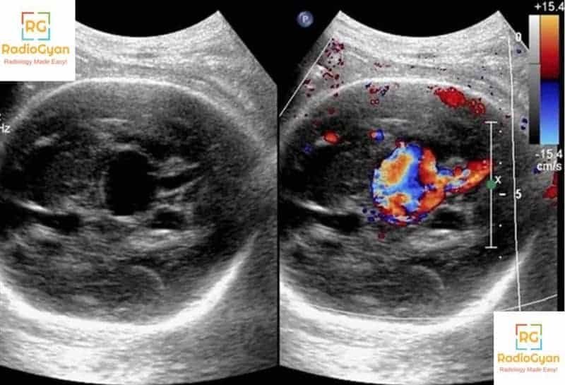 Radiology Spotters set 20 - Fetal Ultrasound spotters | RadioGyan.com