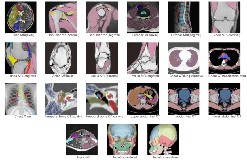 Normal anatomy modules for radiology