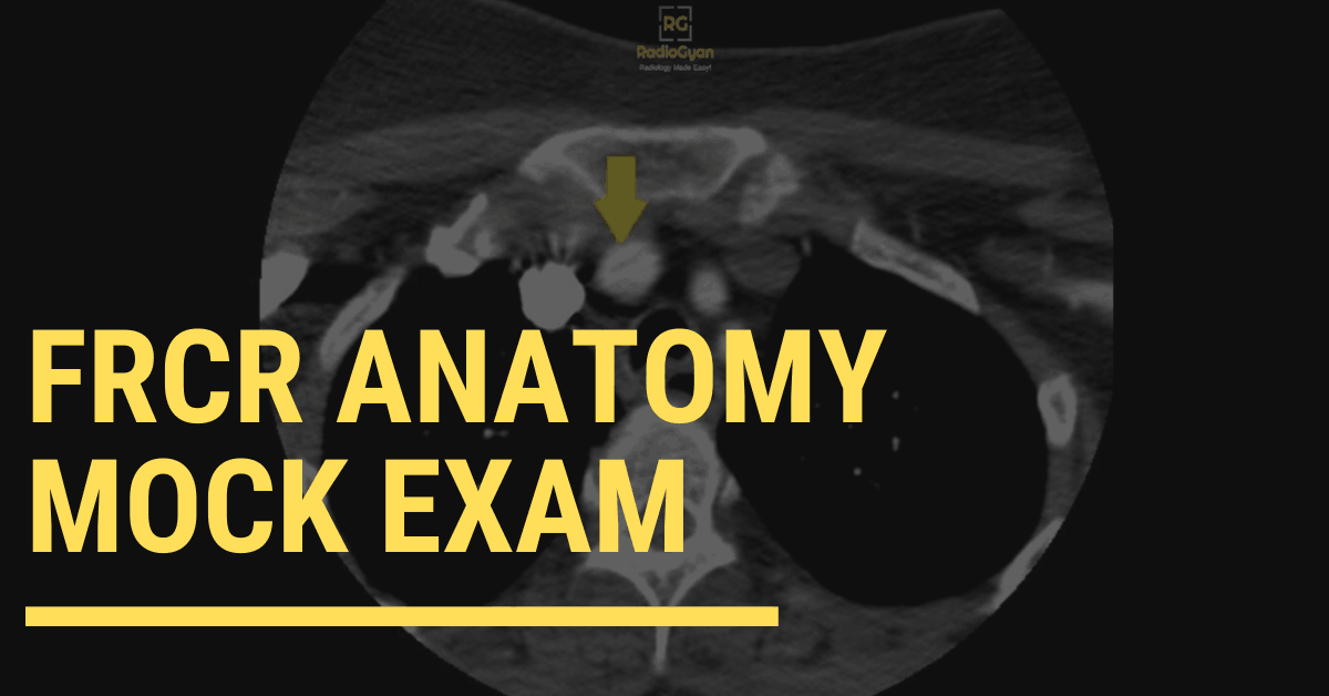 CT image showing brachiocephalic trunk FRCR anatomy mock exam
