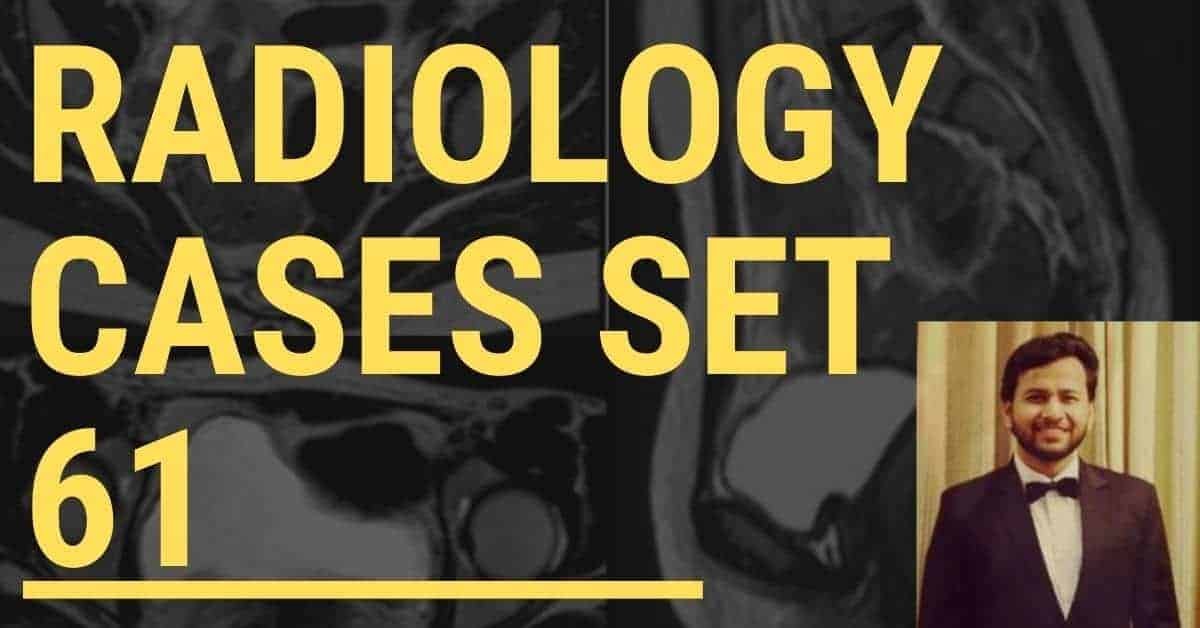 Radiology Board Review Cases Spotter Set 61