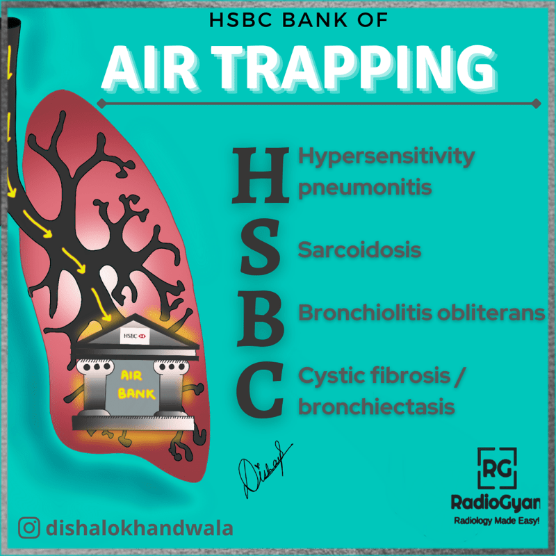Air Trapping Mnemonic