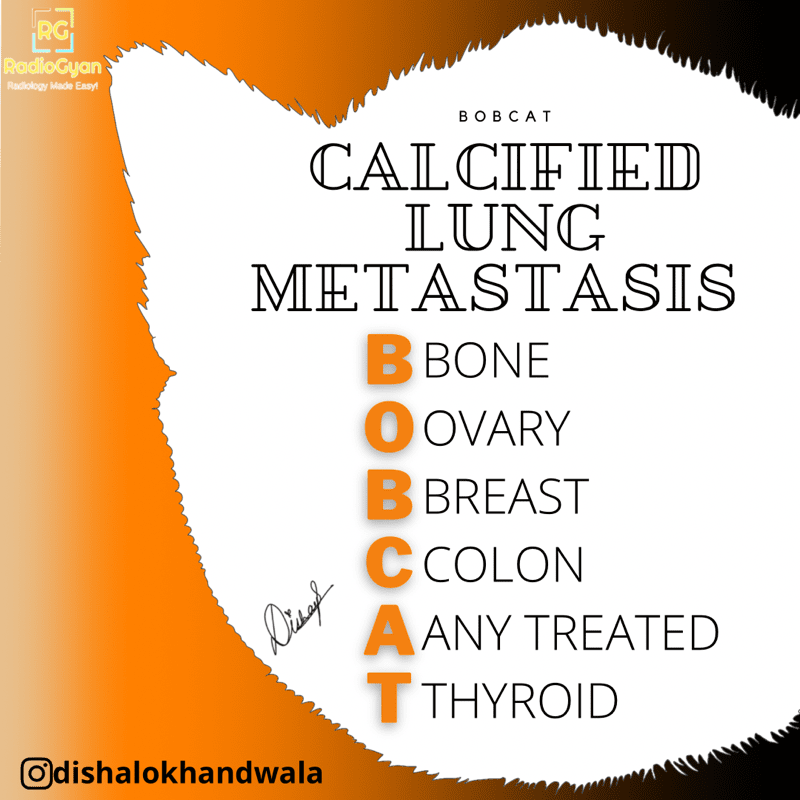 Calcified Lung MetastasisBronchovascular Spread Mnemonic