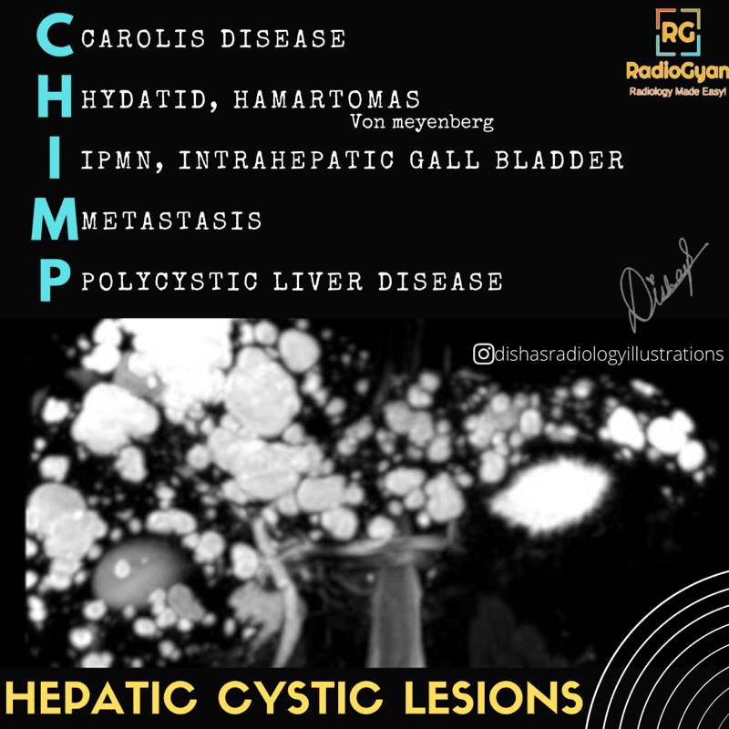 Hepatic Cystic Lesions Differentials 