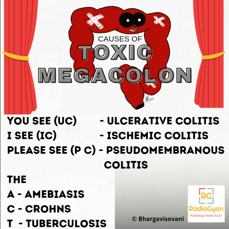Toxic Megacolon Differentials