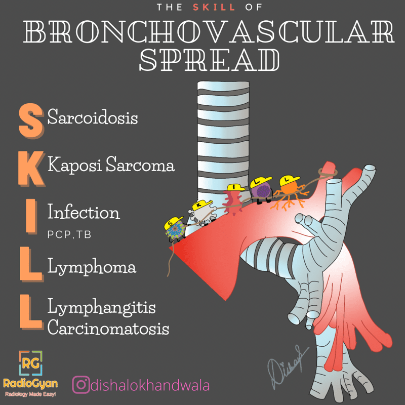 The Skill of Bronchovascular Spread