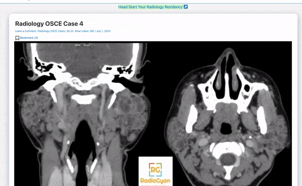Radiology OSCE cases example GIF