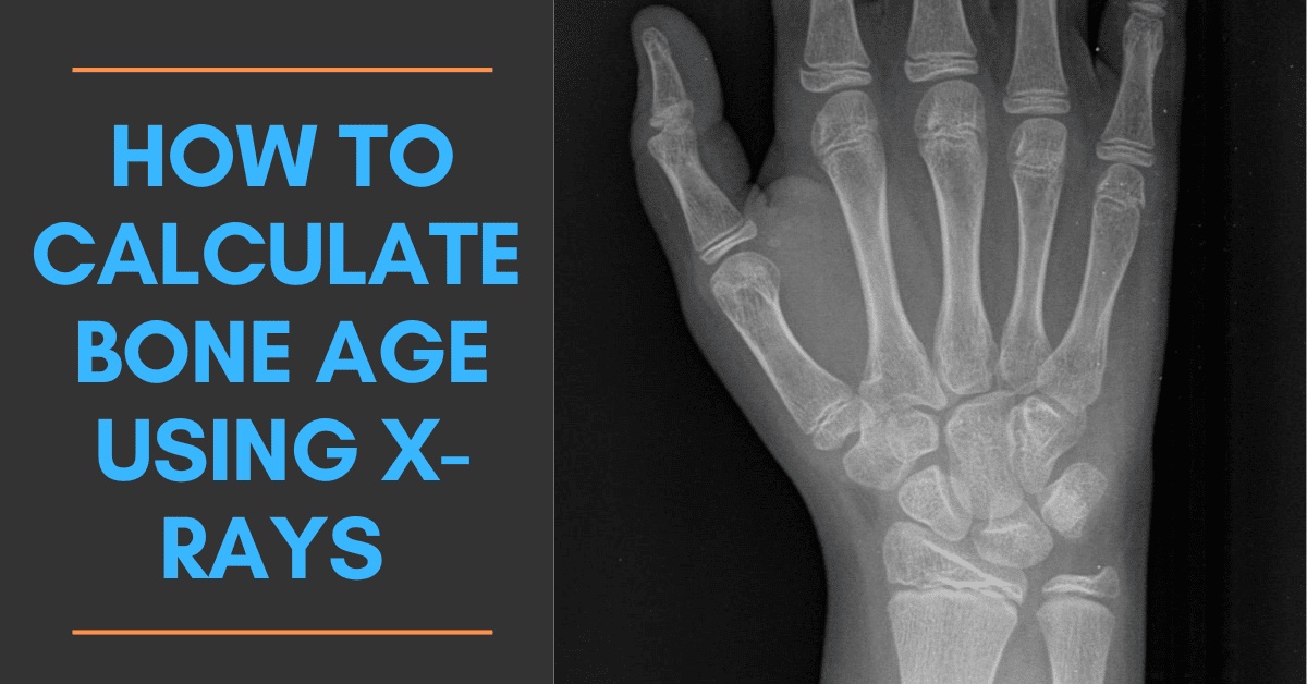 Calculating Bone Age Using Xrays [Includes AIbased Automated Tools