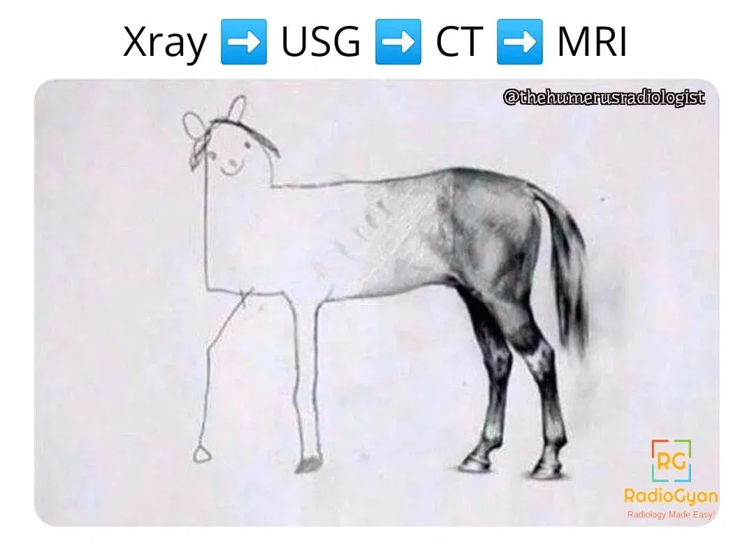 A meme showing how the image quality of a horse sketch improves with different radiological modalities. The first panel is labeled “x-ray” and shows a crude outline of a horse. The second panel is labeled “ultrasound” and shows a fuzzy sketch of a horse with some shading. The third panel is labeled “CT” and shows a detailed drawing of a horse with bones and organs visible. The fourth panel is labeled “MRI” and shows a realistic image of a horse with colors and textures.